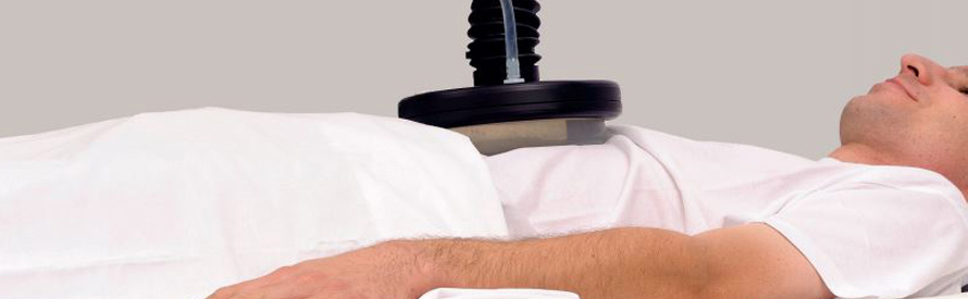 Онкотермия