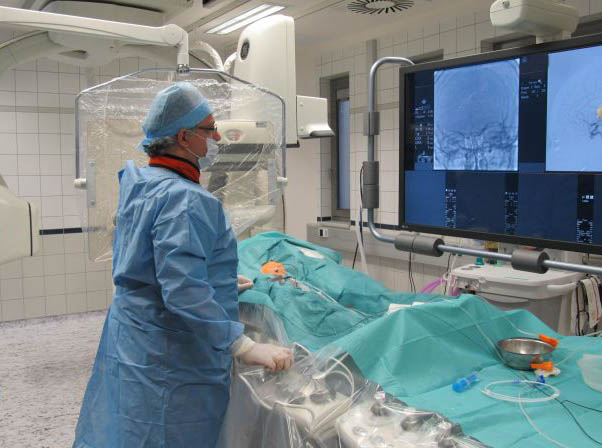 система цифровой субтракционной ангиографии третьего поколения (DSA) 